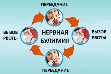 Лечение булимии в Лениногорске